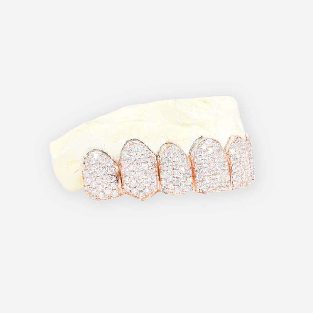 rose gold diamond dust cut grillz