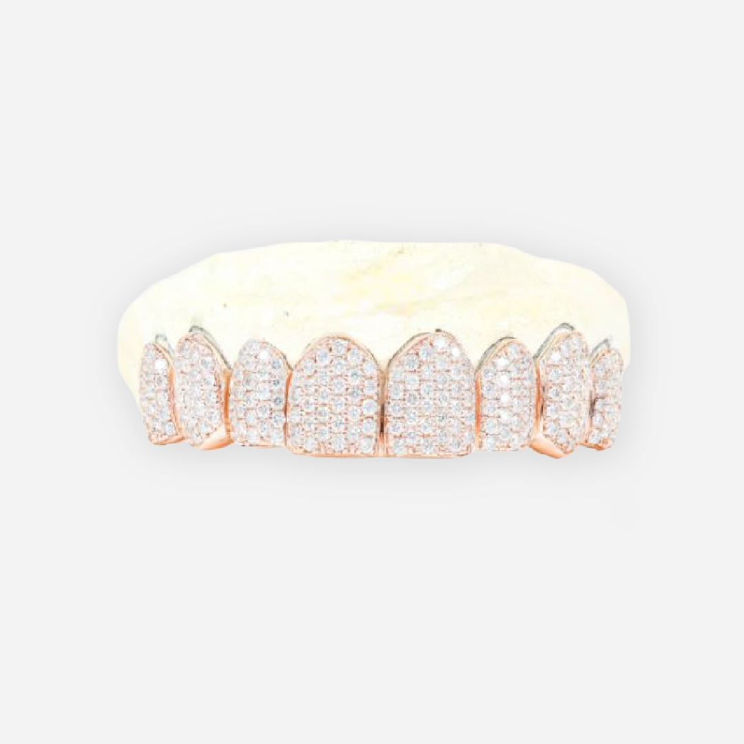 rose gold diamond dust grillz