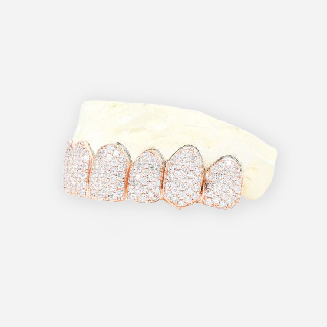rose gold grillz diamond cut