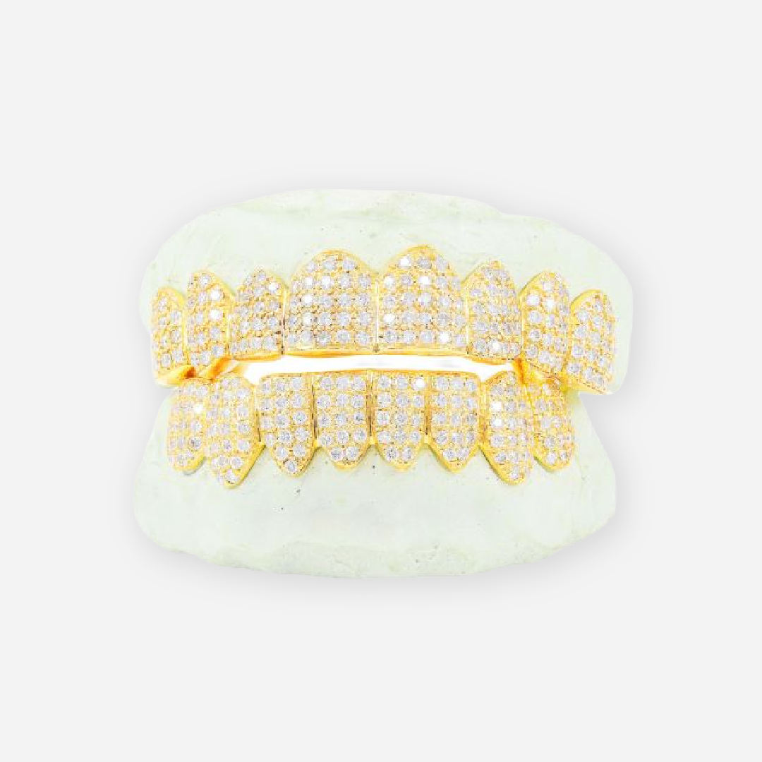 yellow gold diamond grillz