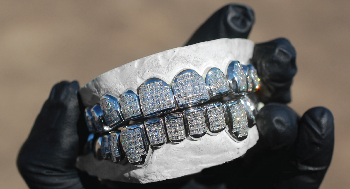 Pricing of diamond grillz