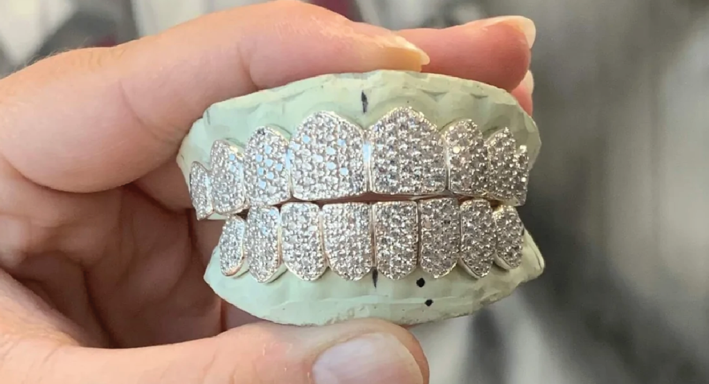 How Much Are Diamond Grillz? RRP Diamond