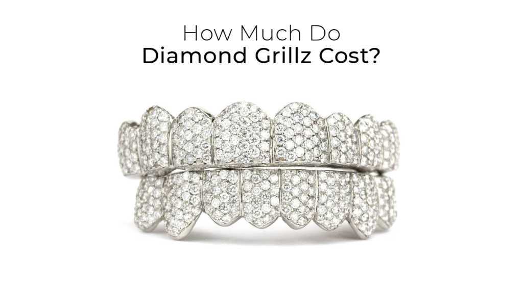 How Much Are Diamond Grillz? RRP Diamond